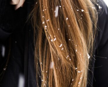 How To Get Rid Of Dandruff Once and For All